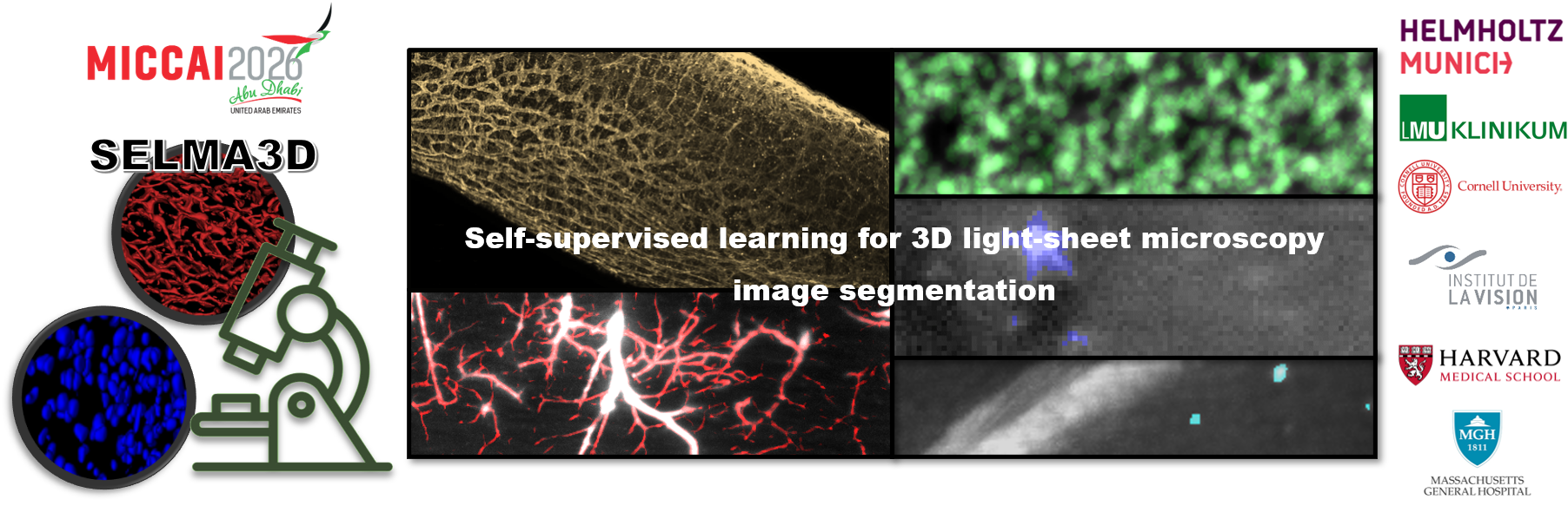 SELMA3D 2026 — Self-supervised learning for 3D light-sheet microscopy image segmentation